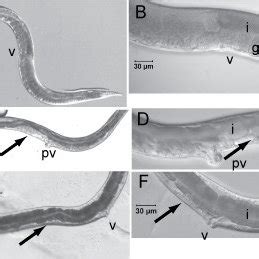 Postembryonic RNAi phenotypes of C. elegans. Caenorhabditis elegans... | Download Scientific Diagram