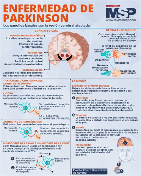 Enfermedad de Parkinson Infografía