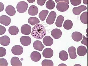 Plasmodium vivax schizont | Hematology, Medical laboratory science, Medical laboratory scientist