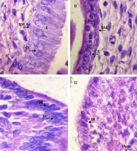 Photomicrograph Of Endometrial Epithelium From Control And Sodium