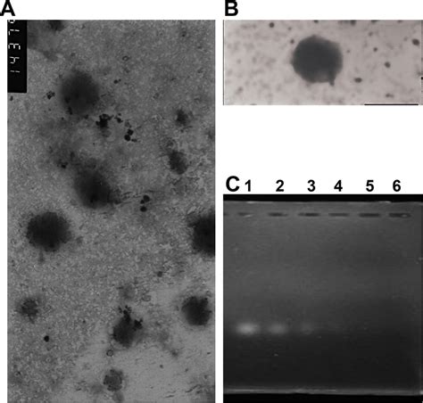 Characterization Of SLN And SLN STAT3 Decoy ODN Complexes A TEM