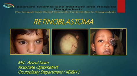 Retinoblastoma Ppt