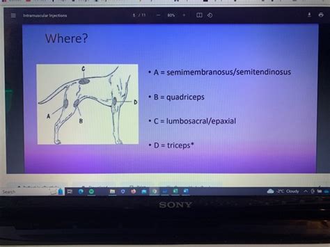 Intramuscular Injections IM Flashcards Quizlet