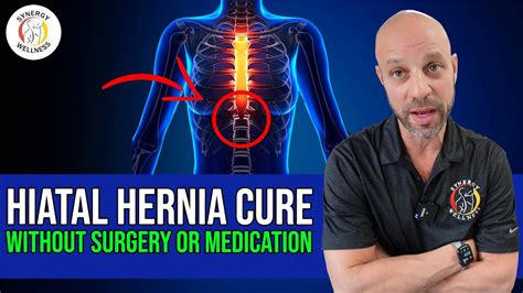 Hiatal Hernia Cure Without Surgery Or Medication Youtube