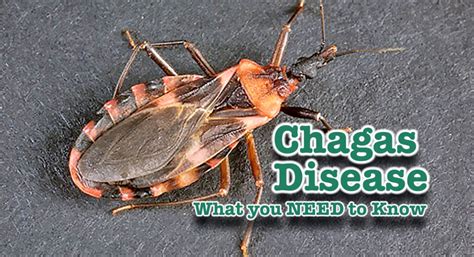 What You Need To Know About Chagas Disease Mega Doctor News