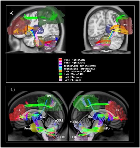 Cerebro-cerebellar pathways for verbal working memory | The Clinical ...