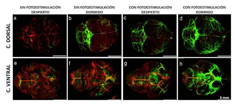 Estimular El Cerebro Con Luz Láser Durante El Sueño Puede Mejorar El Aprendizaje Y La Memoria