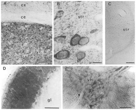 Striatin Is Present In The Cns Motor System Immunocytochemical