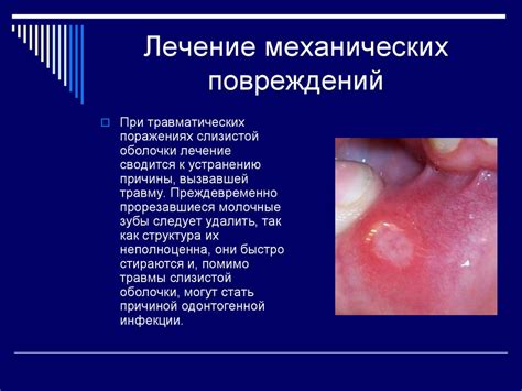 Травматические поражения слизистой полости рта - презентация онлайн
