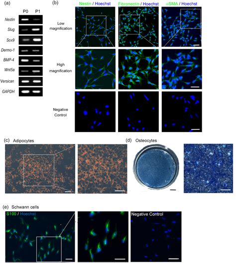 Characterisation Of IPSC SKPs Differentiated On P LM111 E8 Fragments