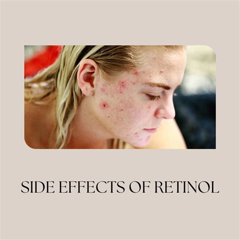 How Long Should You Use Retinol Cream For Lifestyle In Cloud Uae