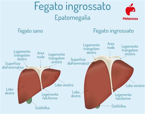 Fegato Cos Quali Sono Le Sue Funzioni E Le Principali Malattie Epatiche