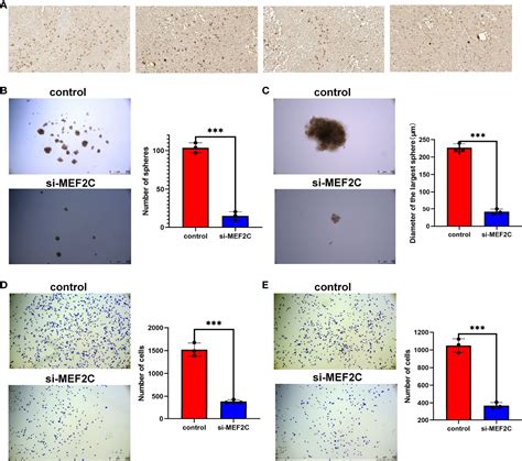 Frontiers Molecular Subtypes Of Osteosarcoma Classified By Cancer