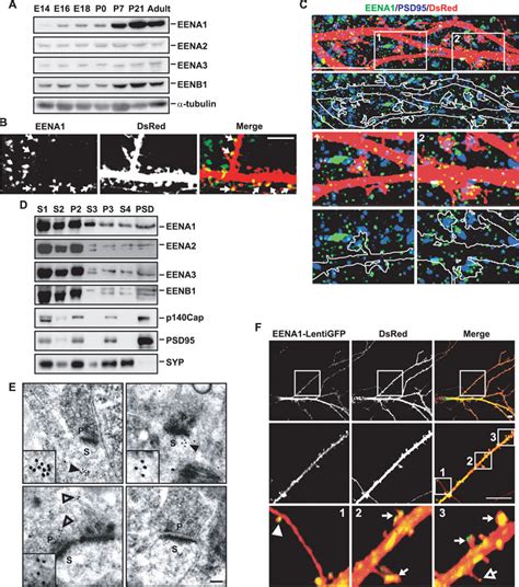 Endophilin A Localizes In Dendritic Shafts And Spines In Mature