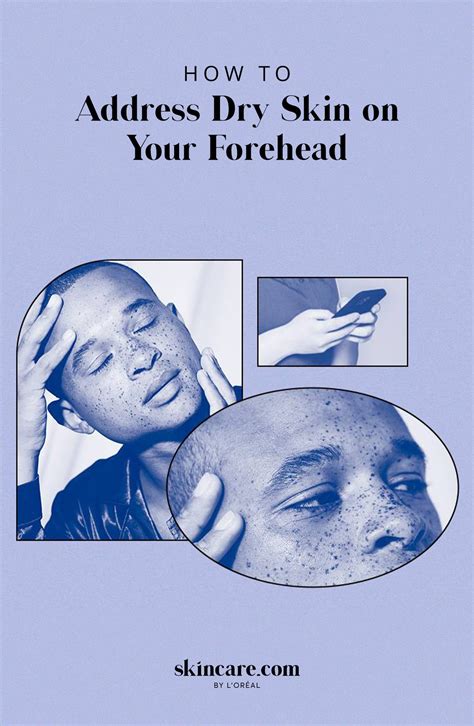 Dry Skin On Forehead Causes And How To Prevent It Powered By Loréal