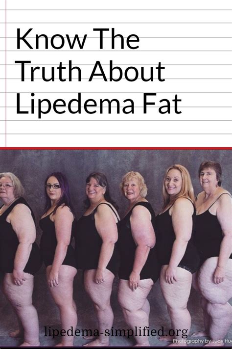 Differences Between Normal Body Fat And Lipedema Fat Lipedema