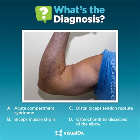 What’s causing this weightlifter’s “Popeye” arm? Let’s diagnose. | VisualDx