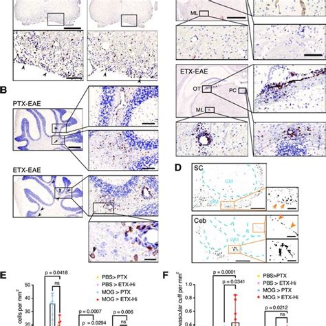 Etx Eae Mice Show Increased Cd Lymphocyte Infiltration In The