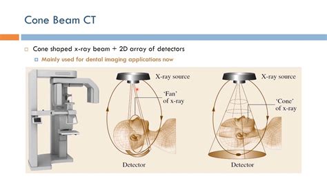 Conebeam Ct Of The Head And Neck Part Physical Off