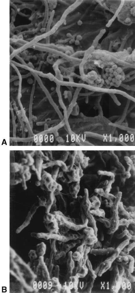 Effect Of Mulundocandin On The Morphology Of A Fumiga Tus Wghu