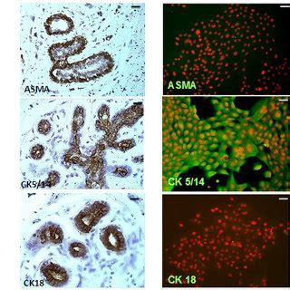 Characterization Of Primary Human Mammary Epithelial Cells