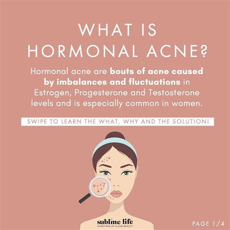 How To Treat Rosacea And Menopausal Acne Artofit