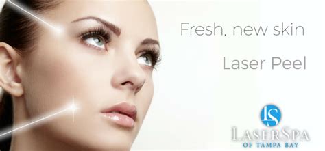 Laser Peel Laserspa Of Tampa Bay