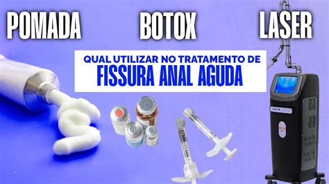 Tratamento fissura anal aguda Pomada Botox LASER gás carbônico YouTube