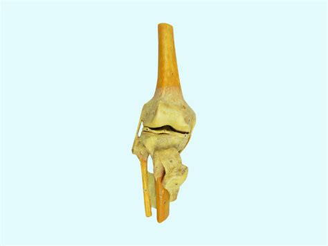 Plastination of Human Body For Medical School - Plastination