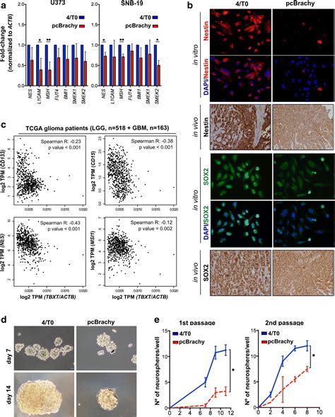 Brachyury Is Associated With Glioma Differentiation And Response To