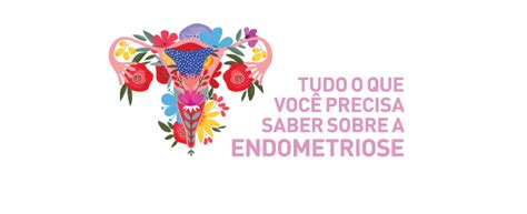 Tudo O Que Voc Precisa Saber Sobre A Endometriose Laborat Rio