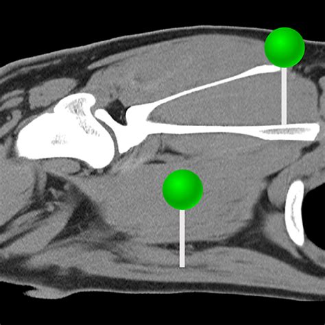 Shoulder anatomy of the dog - normal anatomy | vet-Anatomy