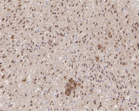 Amyloid Beta A4 Precursor App Recombinant Rabbit Monoclonal Antibody