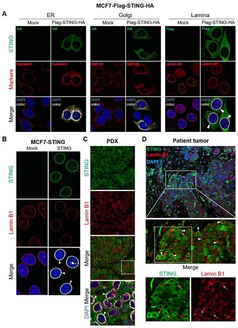 Nuclear Sting Co Localizes With The Lamina In Breast Cancer Cells And