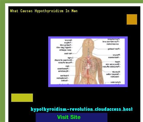 What Causes Hypothyroidism In Men 135550 Hypothyroidism Revolution