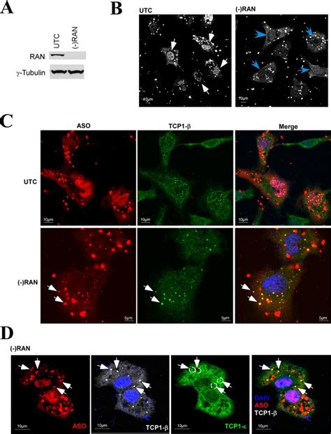 Reduction Of Ran Can Lead To The Formation Of Cytoplasmic Ps Body Like