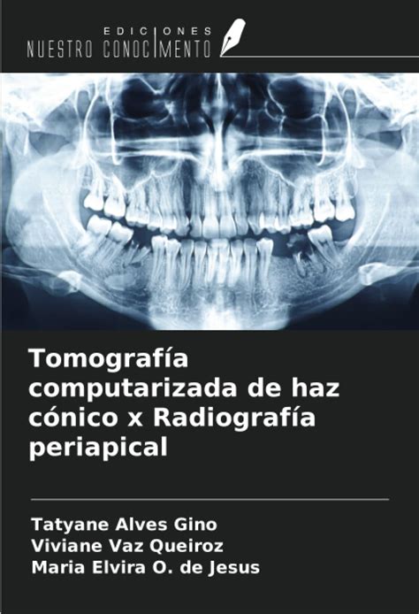 Tomografía computarizada de haz cónico x Radiografía periapical by