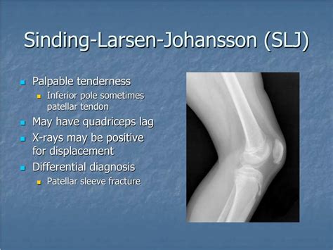 PPT Growing Pains Injury And Skeletal Immaturity PowerPoint