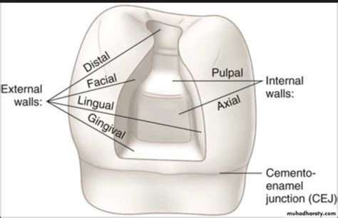 The Theory Of Tooth Preparations Flashcards Quizlet