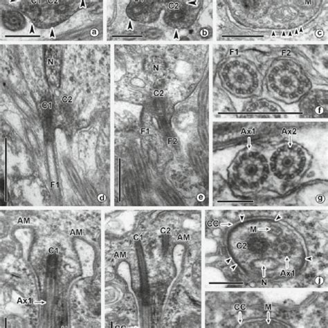 Schematic Reconstruction Of The Main Stages Of Spermiogenesis In C