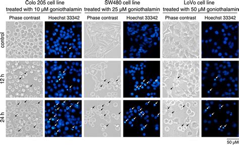 Apoptosis Induction In Colo Sw And Lovo Cells Treated With