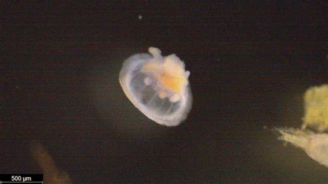 Could someone help me with a zooplankton identification ? | ResearchGate