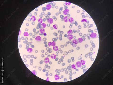 Immature And Mature White Blood Cells Segmented Neutrophil Blast Cells