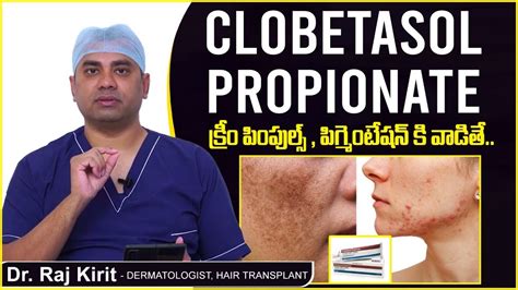 పింపుల్స్ పిగ్మెంటేషన్ Steroid Cream Side Effects Clobetasol Propionate Cream Celestee