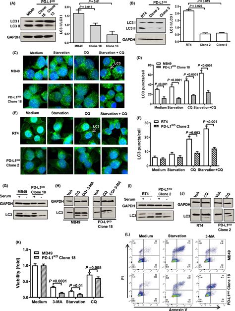 Bc Cell‐intrinsic Pd‐l1 Promotes Autophagy Ab Western Blot Showing