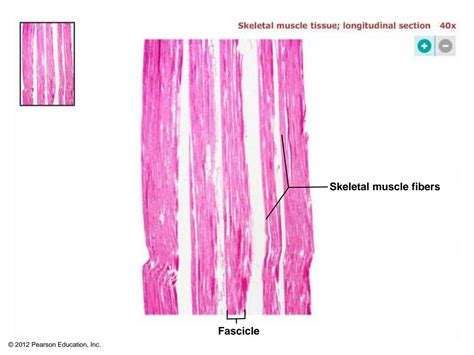 Solution Muscle Histology Slides Studypool