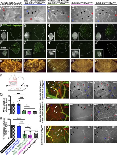 Endothelial Deletion Of Rbpj From P Normalized Brain Avm Phenotypes