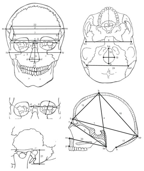 Drawing of skull measurements measured in this study. Written... | Download Scientific Diagram