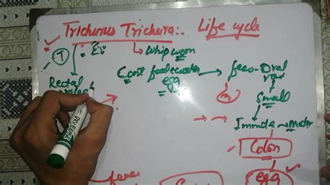 Trichuris Trichiura Life Cycle Trichuris Trichiura Sketchy