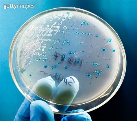 Streptococcus Pneumoniae In Petri Dish Sputum Culture